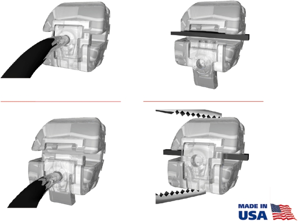 ClearSlide passive, Set (OK / UK 5 - 5), MBT* .022"