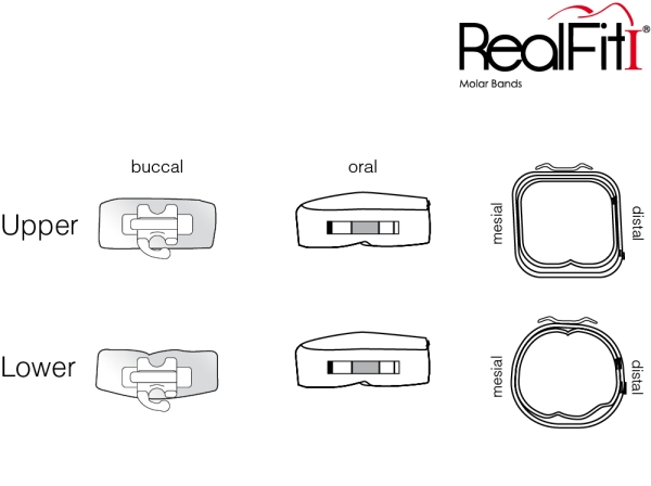 RealFit™ I - OK, 3-fach-Kombination + pal. Schloß (Zahn 17, 16) Roth .018"